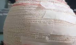 Assaltante vai parar em hospital após levar surra de populares em Manaus