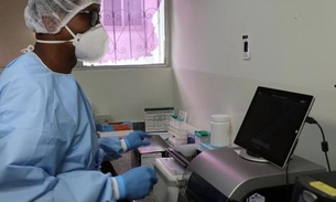 Laboratório no Amazonas começa a realizar testes para diagnóstico do novo coronavírus 