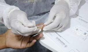 Casos de sífilis em Manaus têm aumento de quase 2 mil