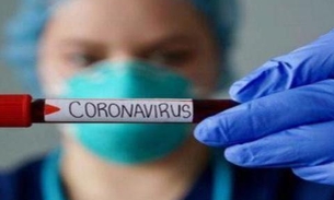 Amazonas tem aumento de 30 casos de coronavírus e números sobem para 111