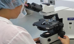 Pesquisadores começam a decifrar identidade do novo coronavírus no Brasil