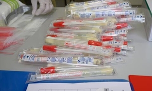 SP tem fila de 12 mil exames para detectar coronavírus