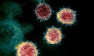 Pacientes com coronavírus podem ter problemas neurológicos, diz estudo