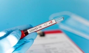 Com 51 novos casos, Amazonas tem 311 infectados por coronavírus 