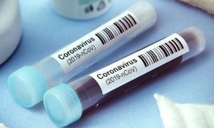 Brasil tem 67 novas mortes por coronavírus, e total de óbitos é de 553
