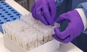 Pesquisa mapeia profissões com maior risco de contágio de coronavírus 