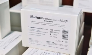 Amazonas recebe mais 10 mil testes rápidos para coronavírus