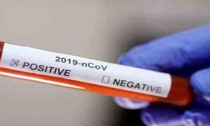 Brasil ultrapassa mil mortes por coronavírus 