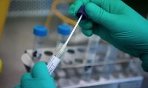 Em Manaus, profissionais de saúde e policiais terão unidades para testes rápidos do Covid-19 