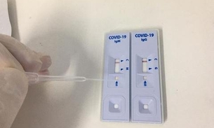 Ufam realiza testes rápidos para controle da Covid-19 em profissionais da saúde 