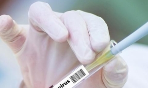 Pesquisadores de Manaus são perseguidos após estudo com cloroquina em pacientes de Covid-19