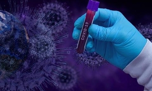 Em 2 meses, coronavírus supera número de mortes por H1N1 no Brasil
