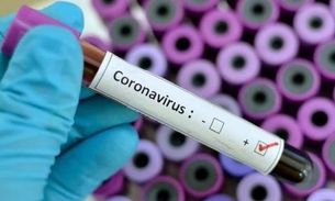 Interior do Amazonas chega a 380 casos de coronavírus 