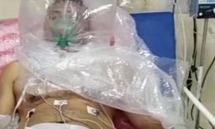 Vídeo de paciente respirando em cápsula improvisada com sacola plástica viraliza em Manaus 