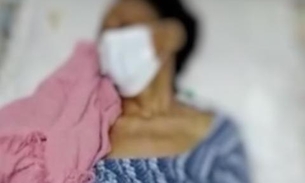 Em Manaus, idosa com suspeita de Covid-19 morre à espera de leito em hospital