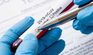 Ministério da Saúde envia mais 8 mil testes de Covid-19 para o Amazonas