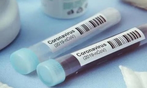 OMS alerta para a incerteza sobre casos de reinfecção do covid-19