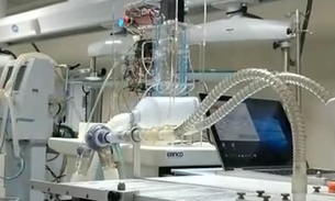 Respirador 15 vezes mais barato, criado por brasileiros, é aprovado em testes com humanos