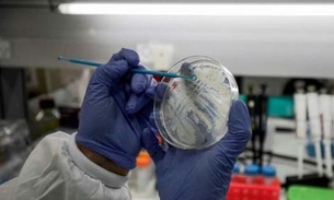 Israel anuncia descoberta de anticorpo para o coronavírus