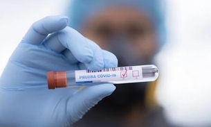 Em dois meses, Brasil tem mais de 8 mil mortes confirmadas por Covid-19 