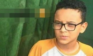 É grave o estado do menino baleado na cabeça na frente de igreja em Manaus