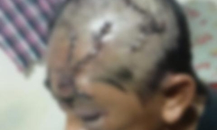 Mulher tem rosto desfigurado após ser atacada por ex-genro em Manaus