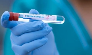 Interior do Amazonas se aproxima dos 9 mil casos de Covid-19 