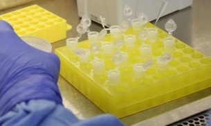 Termina hoje 1º etapa de levantamento sobre evolução de covid-19 no Brasil