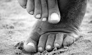 Sofre com unha encravada? Conheça remédios caseiros para tratar problema