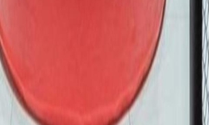 Motel causa na web ao lançar suíte inspirada em MMA