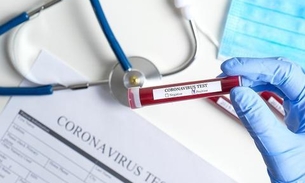 Planos de saúde terão que cobrir novos exames para diagnóstico e tratamento da Covid