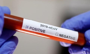 Brasil ultrapassa França e se torna o 4º país com mais mortes por coronavírus