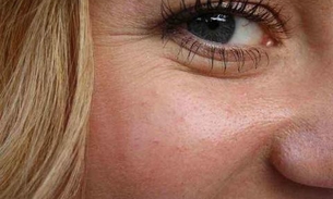 Conheça 5 hábitos que colaboram para o envelhecimento da pele