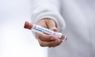 Interior do Amazonas chega a 15.178 infectados e 686 mortos pela Covid-19 