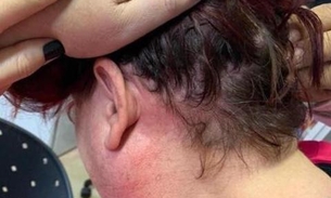 Médica é agredida por marido de grávida em trabalho de parto