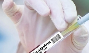 Pesquisadores anunciam que 10 vacinas contra coronavírus entram em fase de testes em humanos