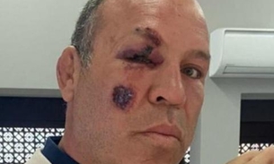 Lutador Wanderley Silva é arremessado em acidente durante passeio de bicicleta