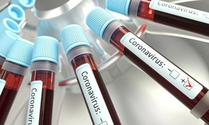 Veja quais são os dados sobre coronavírus que governo vem retirando de divulgações