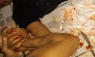 Jovem tem mão decepada ao desobedecer ordem de criminosos no Amazonas 