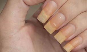 Veja quais motivos que podem deixar suas unhas amarelas