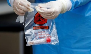 Banco de dados reúne informações anônimas de pacientes com covid-19