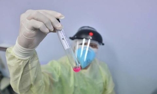 Coari ultrapassa 3 mil infectados por coronavírus; total no interior é de 35.458