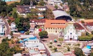 Município do Amazonas contrata empresa para mutirão de cirurgias