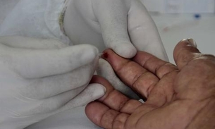 Brasil ultrapassa 50 mil mortes por Covid-19