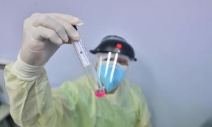 Ipixuna registra primeiros casos de covid-19; interior soma 38. 578 infectados