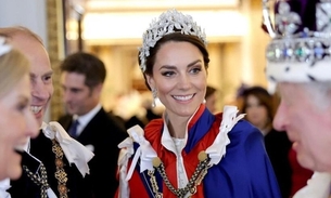 Kate Middleton contraria Família Real e decide enfrentar câncer careca