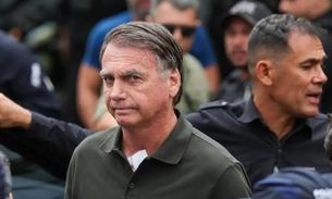 Bolsonaro passou recentemente por cirurgia - Foto: Divulgação 