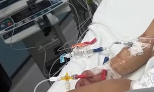 Bebê bebe soda cáustica após confundir garrafa com mamadeira e sofre queimaduras