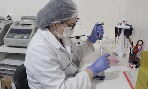 Foto: Carlos Soares/SSP-AM