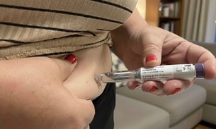 Foto: Divulgação /FVS-RCP 